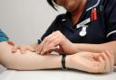 New research says up to half of cancer cases could be stopped from becoming advanced thanks to a simple blood test (Alamy/PA)