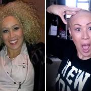 Helena before being diagnosed in March 2014 and after losing her hair in October 2014